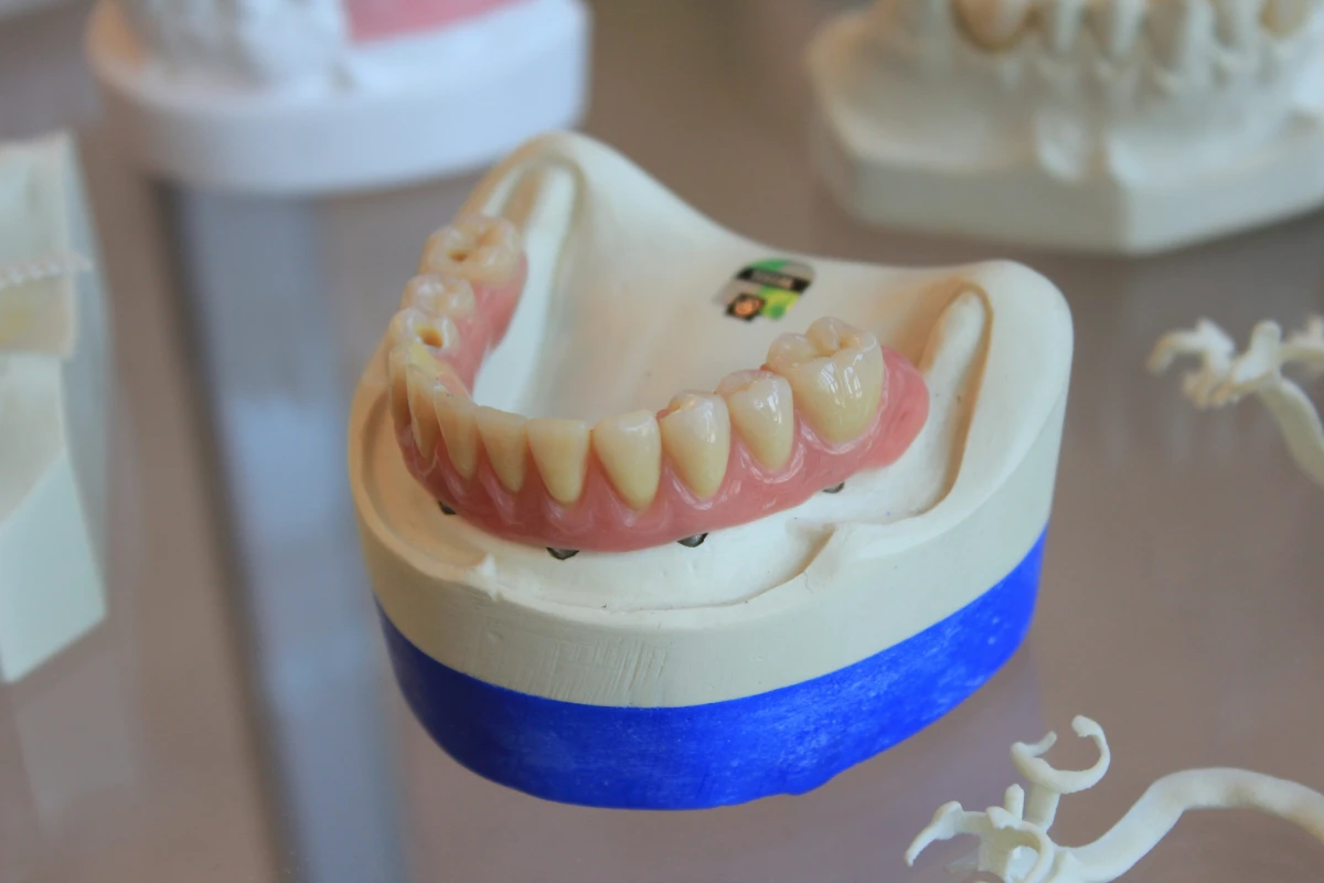 Protèsis dental